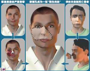 整容过期,换脸时期到来?