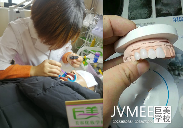 成都纳米美牙贴面培训