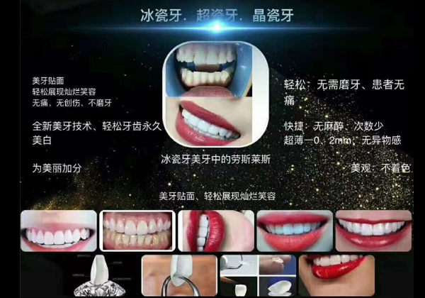 瓷贴面美牙培训