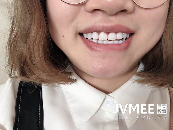 学美牙大要要几多钱