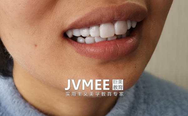 有身了能够学做冰瓷美牙吗