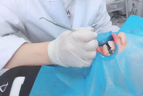 学哪一种美牙结果好