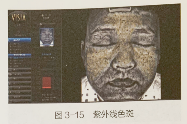 成都美容培训黉舍
