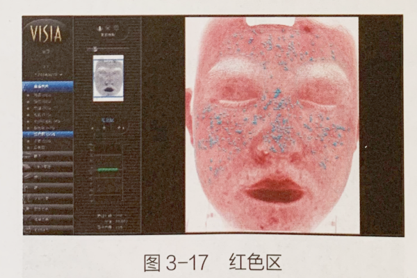 成都美容培训
