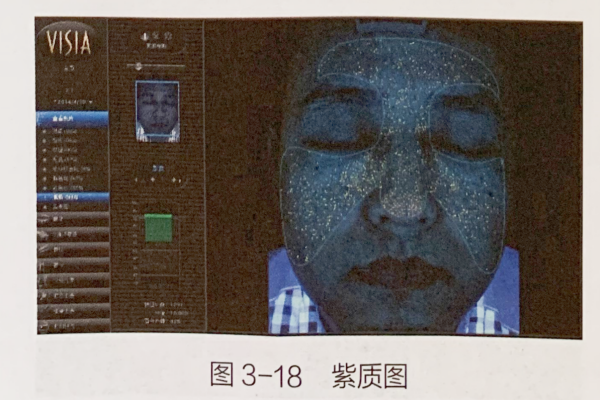 成都美容培训