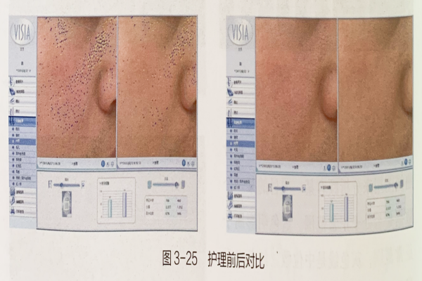 成都美容培训机构