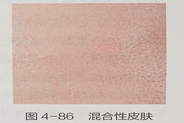 阐发夹杂性皮肤的特色